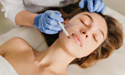 Rhinoplasty
