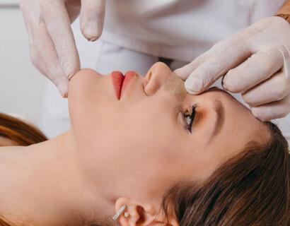 How to Prepare for Rhinoplasty
